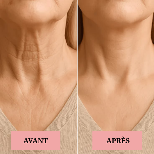 Lifting du visage